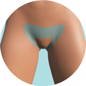 Bikini Retoque