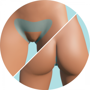 Bikini con Entre Glúteos