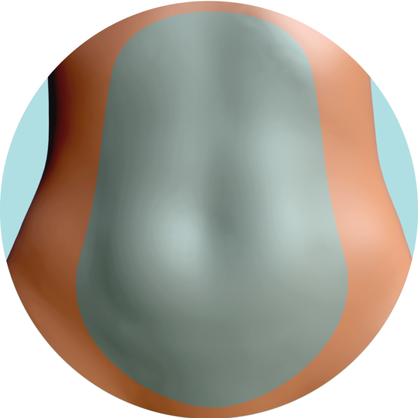 Abdomen