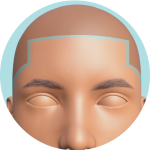 Frente (Hairline) Retoque