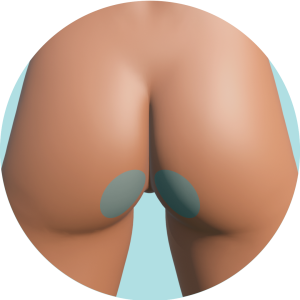 Inferior de Glúteos