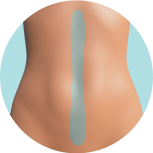 Línea de Abdomen