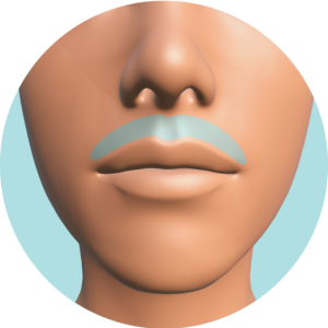 Labio Superior Retoque